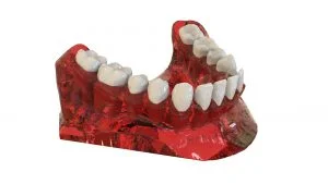 teeth 2833414 1920 300x169 1 | CAD/CAM Programmiersoftware für CNC Maschinen und Industrieroboter